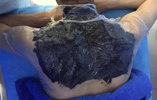 独创四联疗法专治肩周炎，7天康复！德州扑克平台网
平阳部骨科火了！